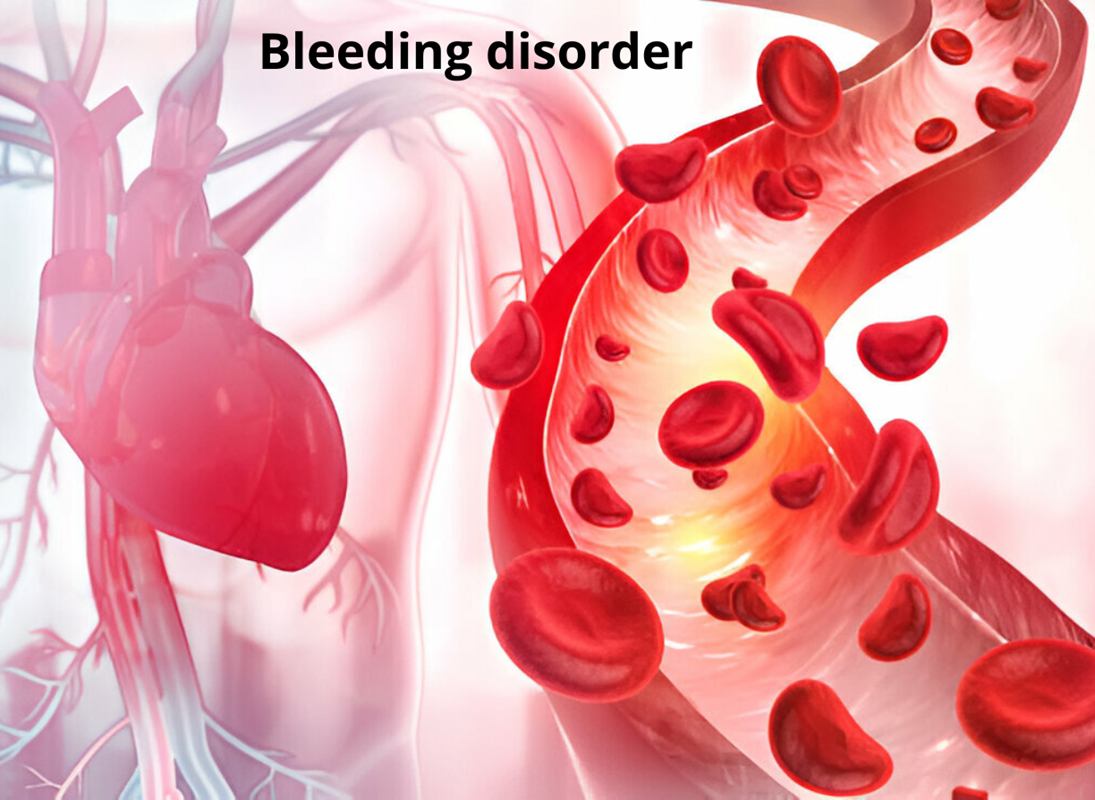 Bleeding Disorder