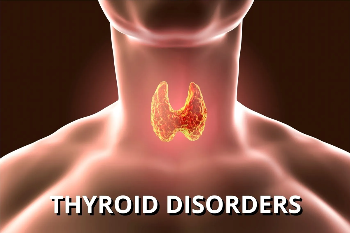 Thyroid Disorders